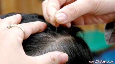 H&agrave; thủ &ocirc; l&agrave; b&agrave;i thuốc rất t&aacute;c dụng trong điều trị t&oacute;c bạc sớm, song đ&ograve;i hỏi bệnh nh&acirc;n phải ki&ecirc;n tr&igrave; v&agrave; sắc đ&uacute;ng c&aacute;ch.