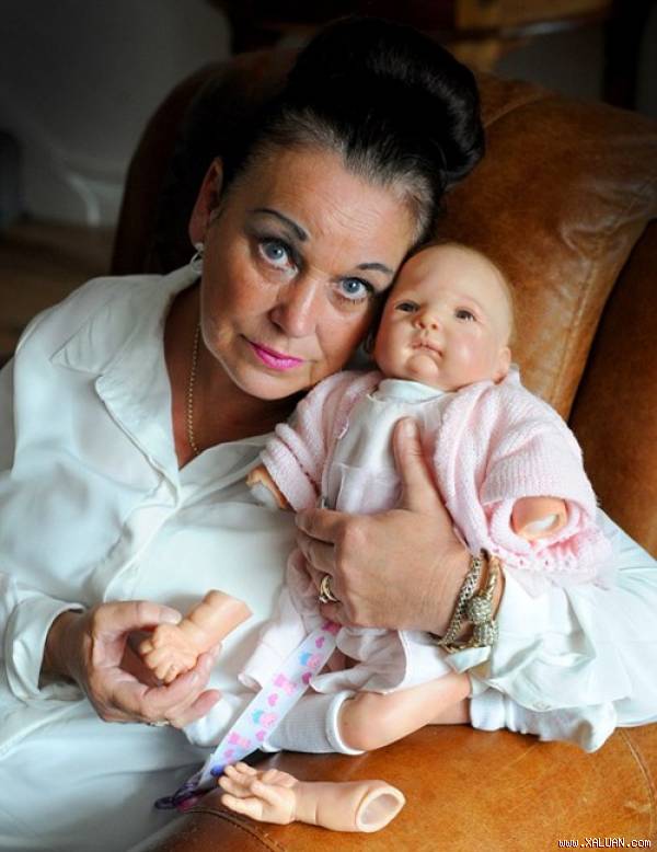    Chị gái bà Susan và con búp bê bị y tá bẻ gẫy.